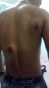 Marcas dos disparos sofridos pelo AEVP de Parelheiros salvo pelo COLETE PARTICULAR